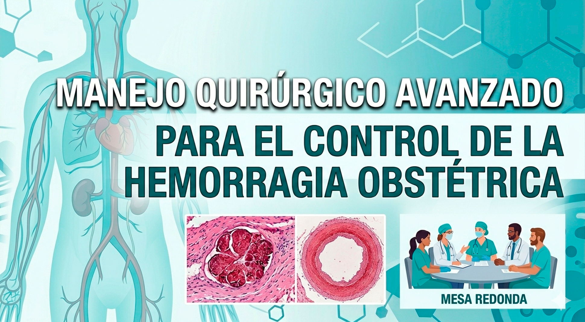Manejo quirúrgico avanzado para el control de la hemorragia obstétrica